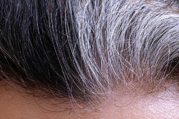 Colloidal copper and grey hair Colloidal copper and grey hair